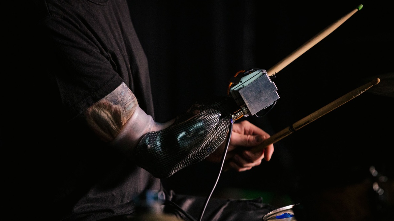 Джейсон Барнс однорукий барабанщик с умным протезом с искусственным интеллектом